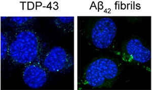 Amyloid formation in ALS: Redefining the role of TDP-43 inclusions