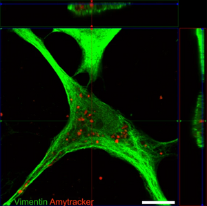 Studying the inflammation-aggregation connection using Amytracker