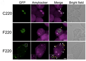 The structural basis of TDP-43 aggregation