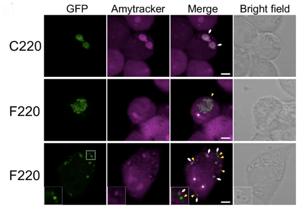 The structural basis of TDP-43 aggregation – Ebba Biotech AB