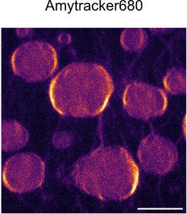 Transition to aggregation in hnRNPA1A condensates visualised using Amytracker