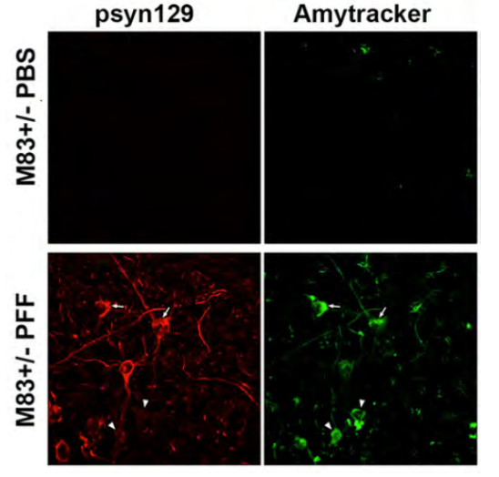 Amytracker is used to shed light on Protein Aggregation in Parkinson’s ...